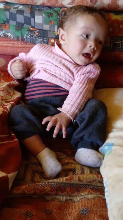 Adbul cerebral palsy